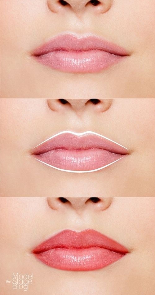 Uneven Lip Shapes