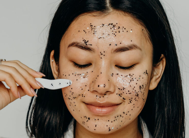 Blackheads: Remedies And Tips To Beat Them And Get Clear Skin