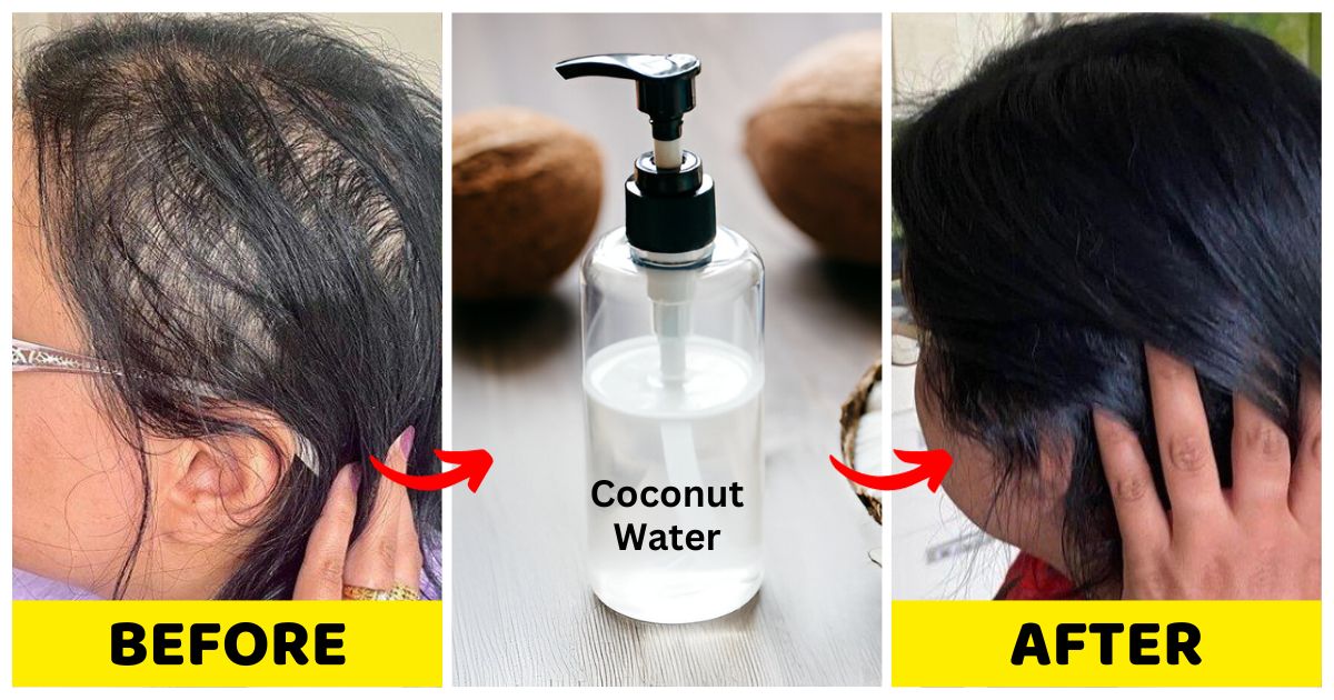 5 Ways To Use Coconut Water To Promote Rapid Hair Growth Woman