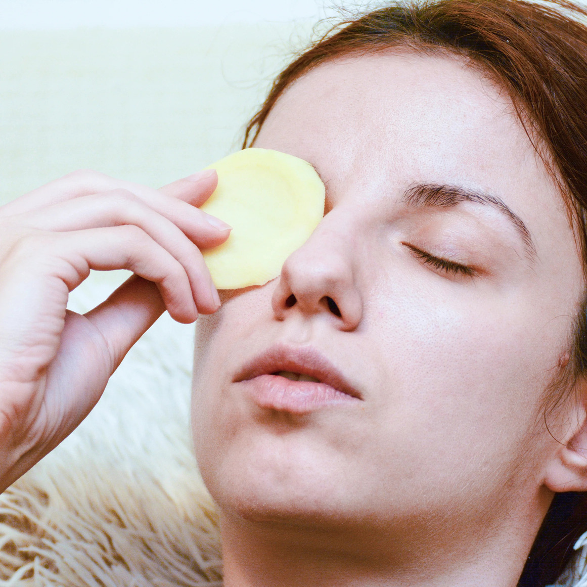 Home Remedy For Dark Circles