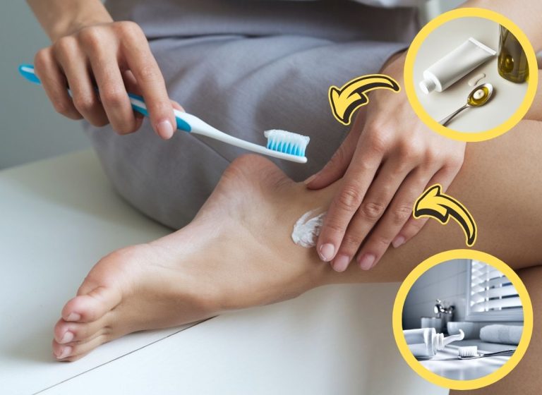 Heal-Cracked-Heels-Using-Toothpaste