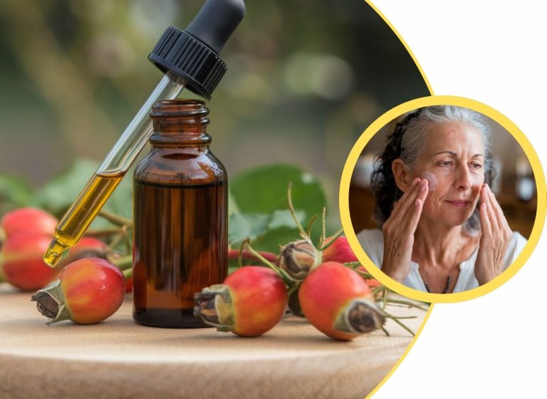 Remove-Age-Spots-With-Rosehip-Oil-Web