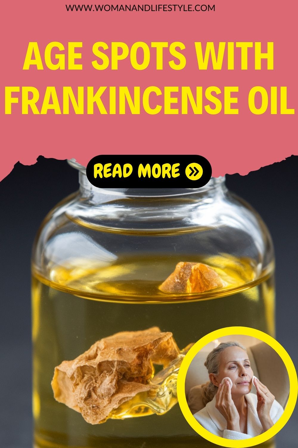 Remove-Age-Spots-with-Frankincense-Oil-Pin