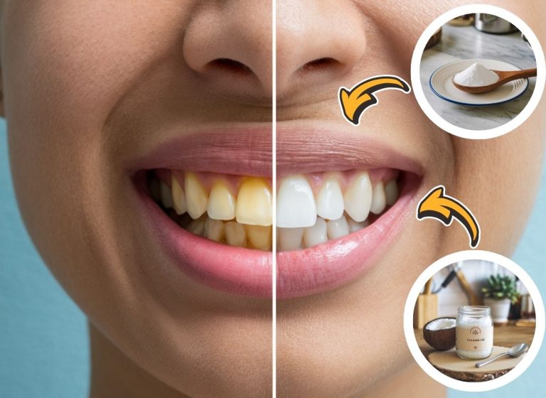 Whiten-Teeth-Baking-Soda-Coconut-Oil