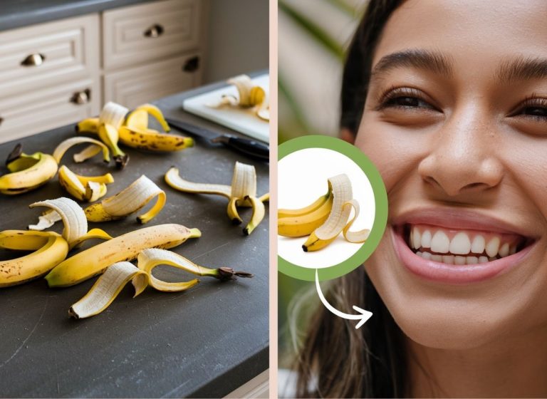 Whiten-Teeth-With-Banana-Peels