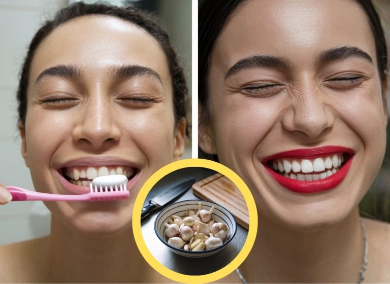 Whiten-Teeth-With-Garlic