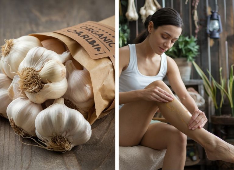 B730-Thumb-Garlic-Varicose-Vein-Remedies