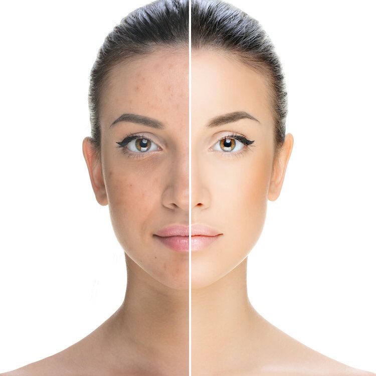 Why-Does-Your-Face-Tan-Differently