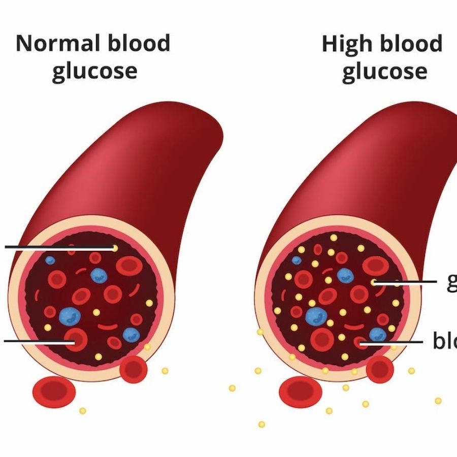 blood-sugar
