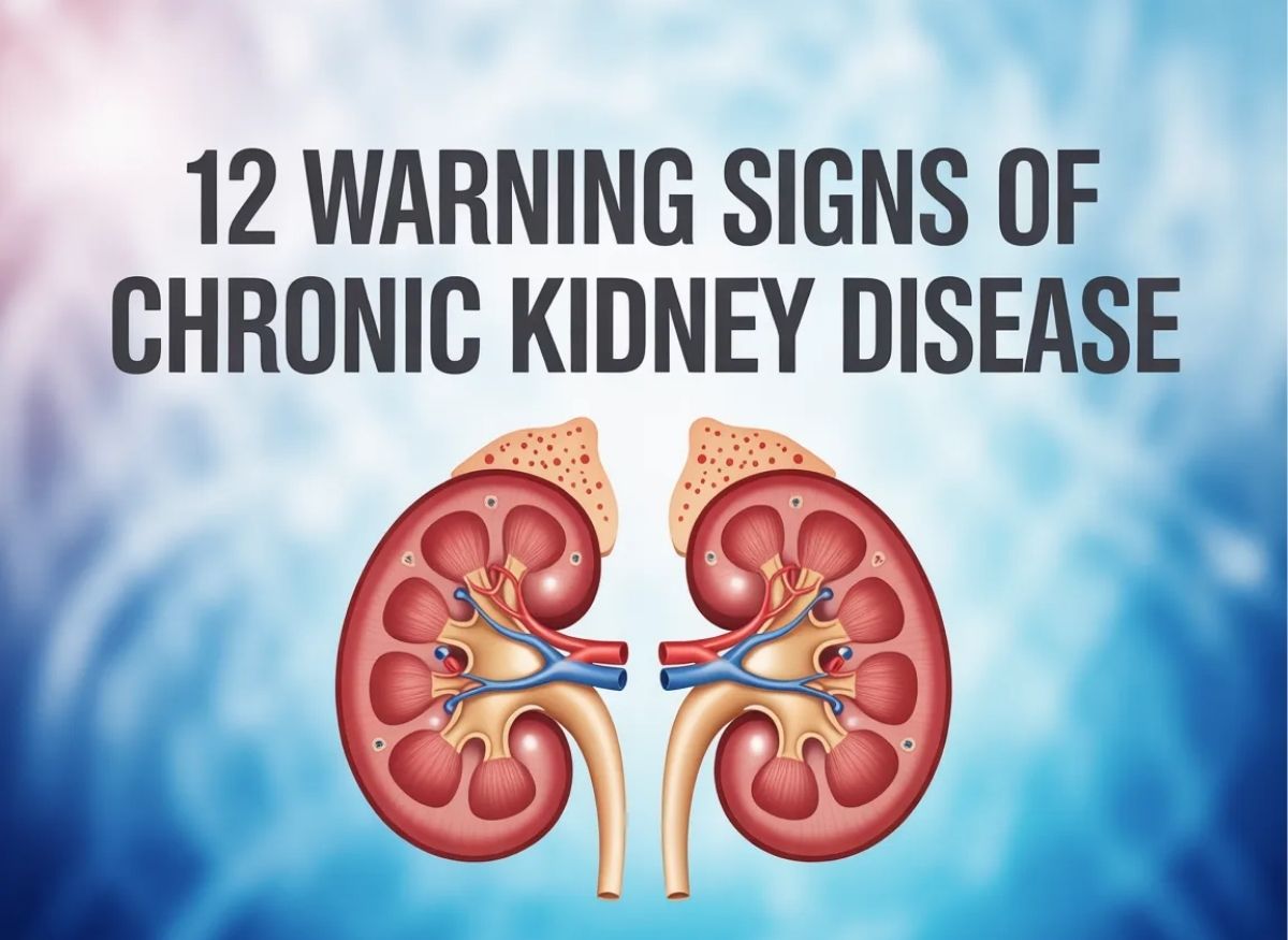 12 Warning Alert Signs of Chronic Kidney Disease Most People Overlook