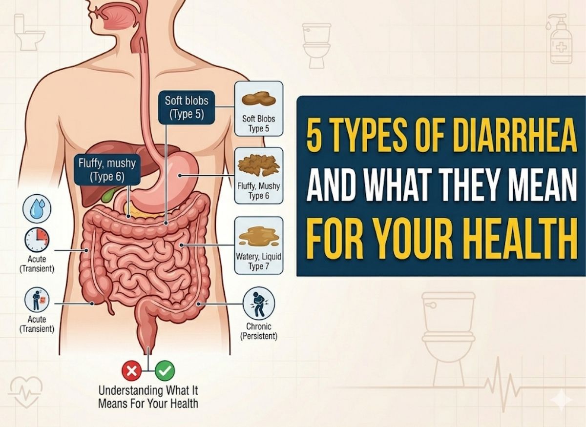 5 Types of Diarrhea and What They Mean for Your Health