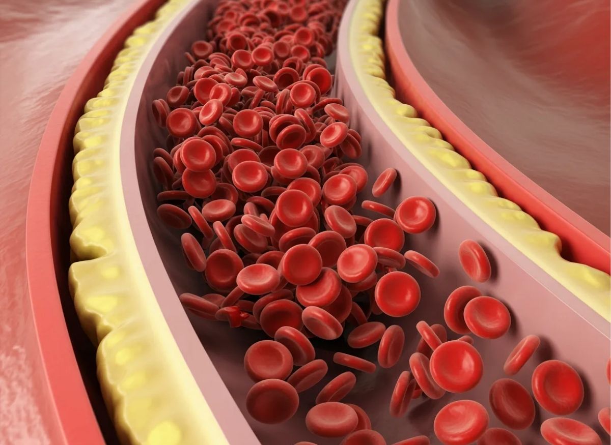 6 Symptoms of Elevated Red Blood Cells You Should Know