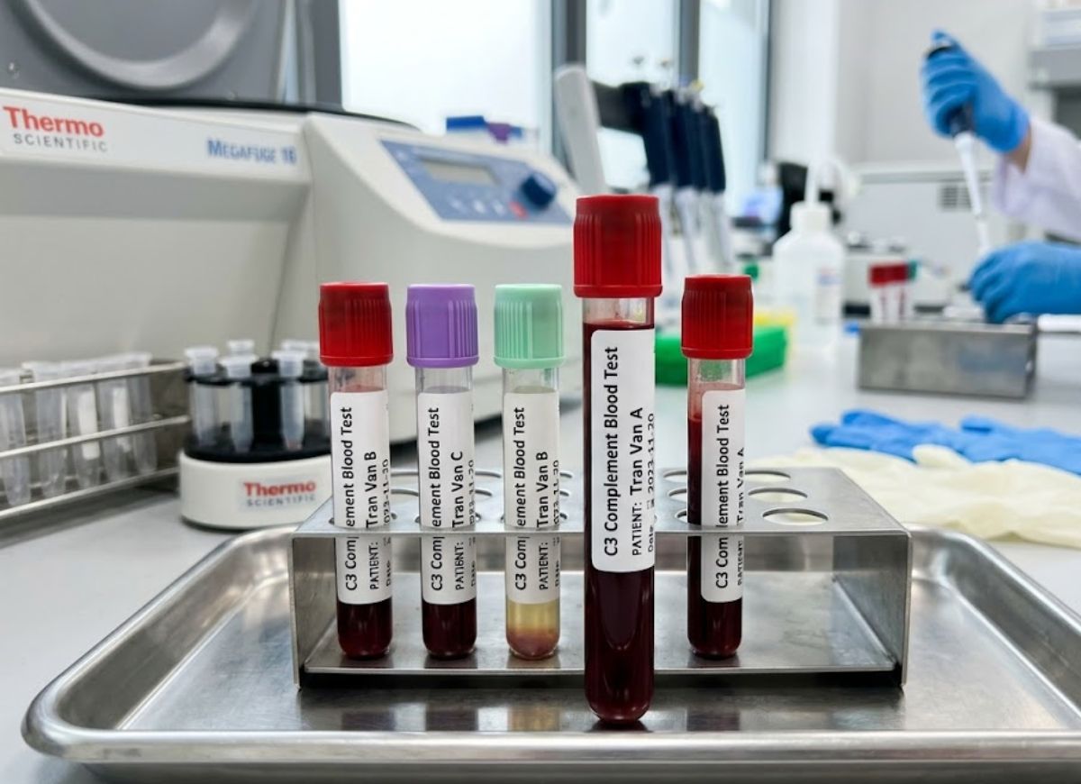 C3 Complement Blood Test Results Explained: What High and Low Levels Mean